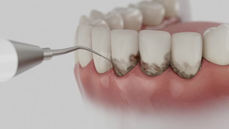 Trusted Teeth Cleaning And Checkup service in Sebring, OH - Dentist Open Now